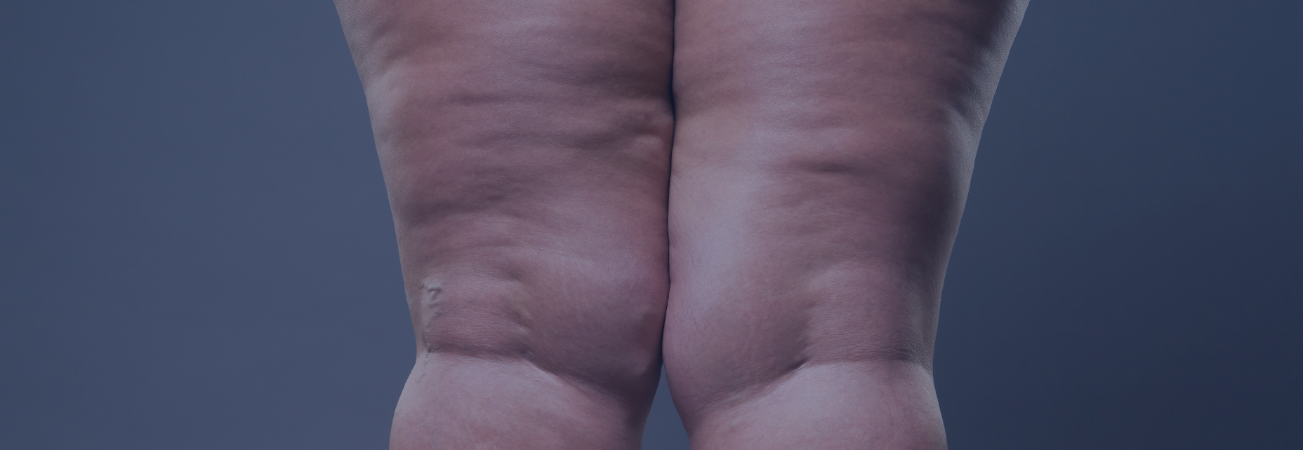 Dermatological wounds