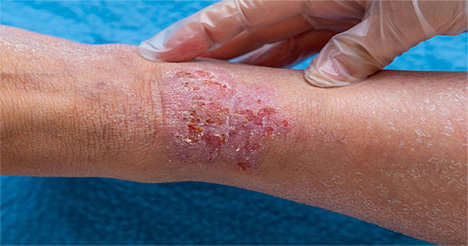 dermatology