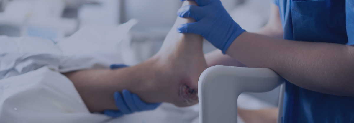 pressure ulcer